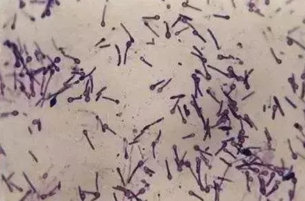 致死率近100%！男子感染险些丧命，有这些表现千万别大意